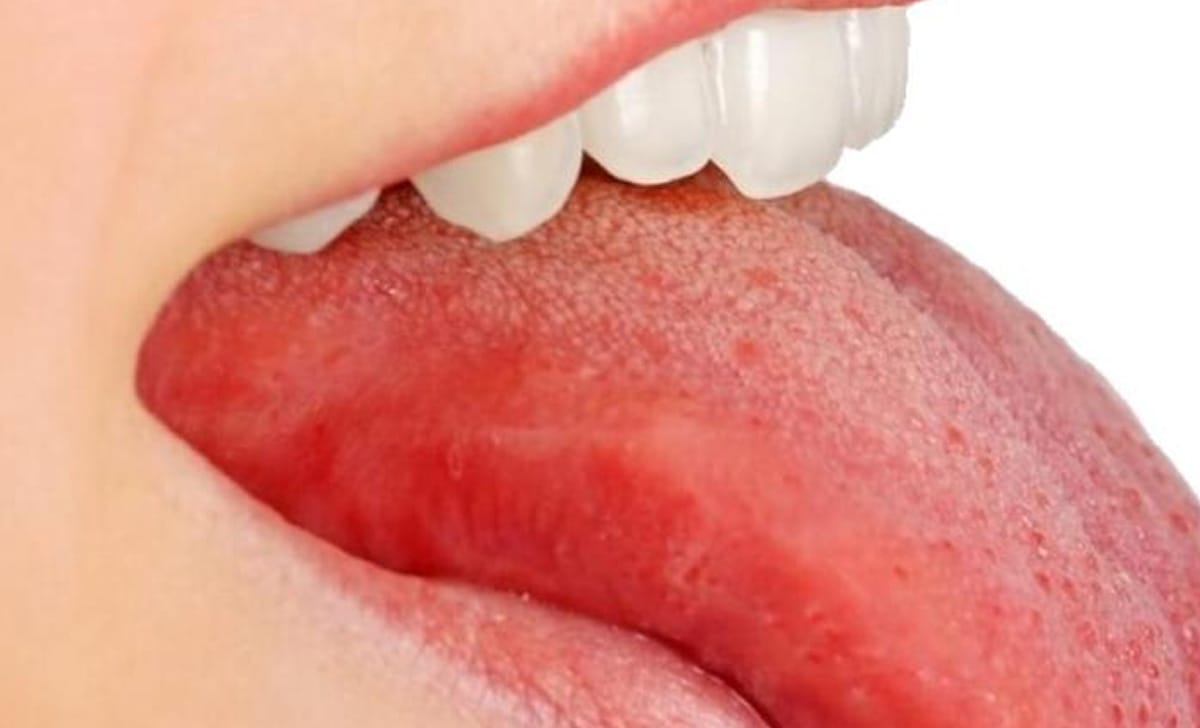 il colore della lingua può dire molto sul nostro stato di salute
