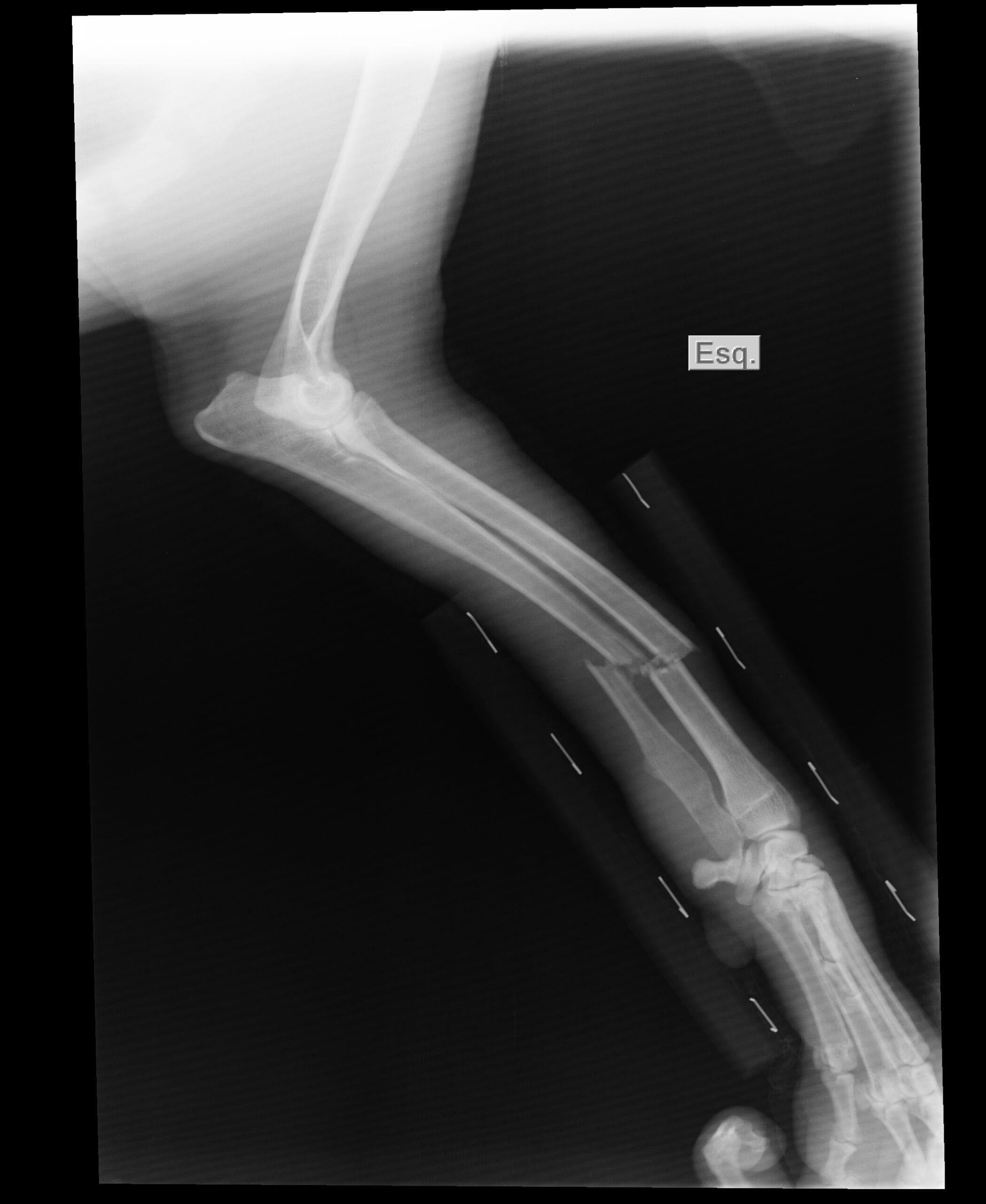 radiografie