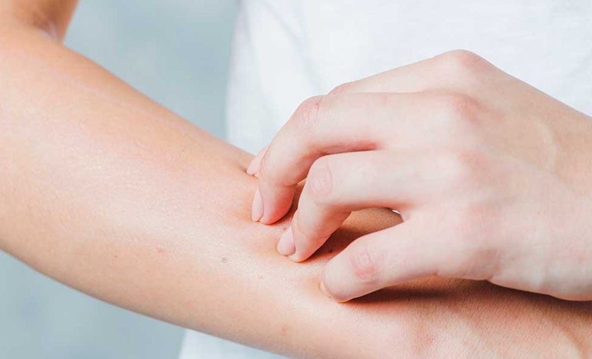 intolleranza alimentare