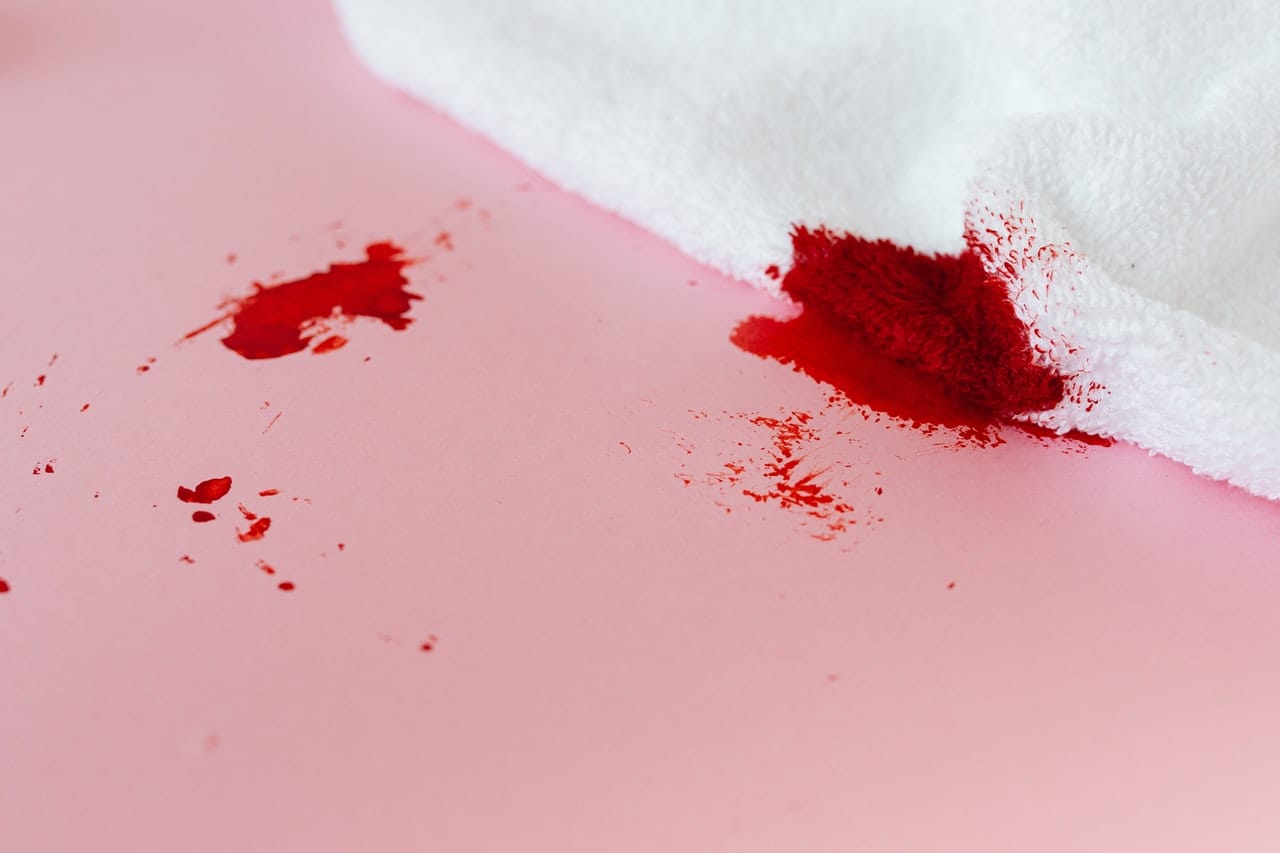 Come togliere macchie di sangue dai tessuti con acqua ossigenata