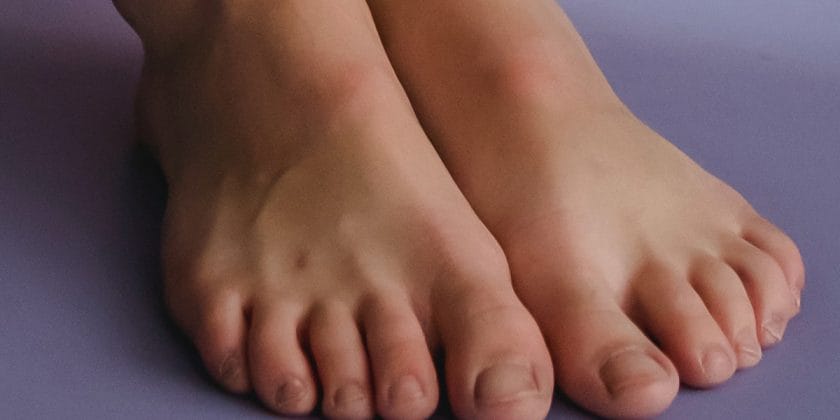 calli piedi