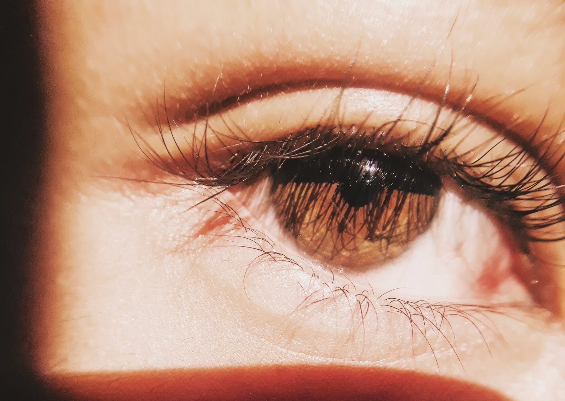 occhi rossi, bruciore