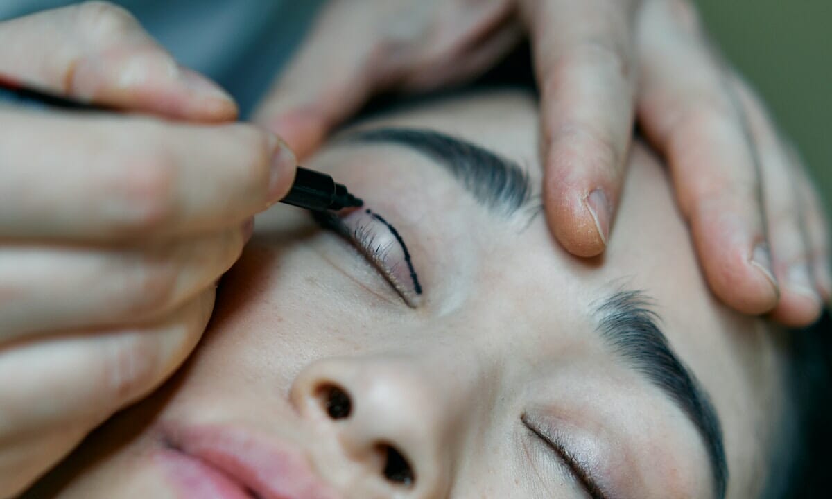 Blefaroplastica non chirurgica