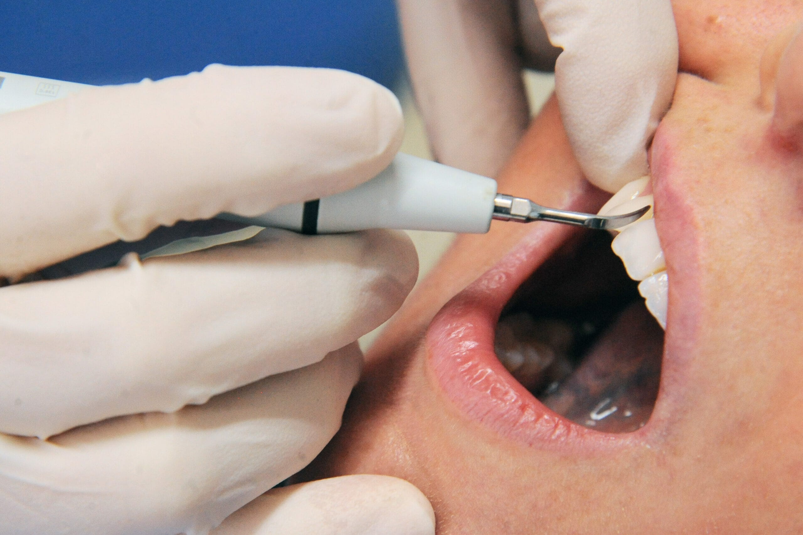 Curarsi i denti in Italia-proiezionidiborsa.it